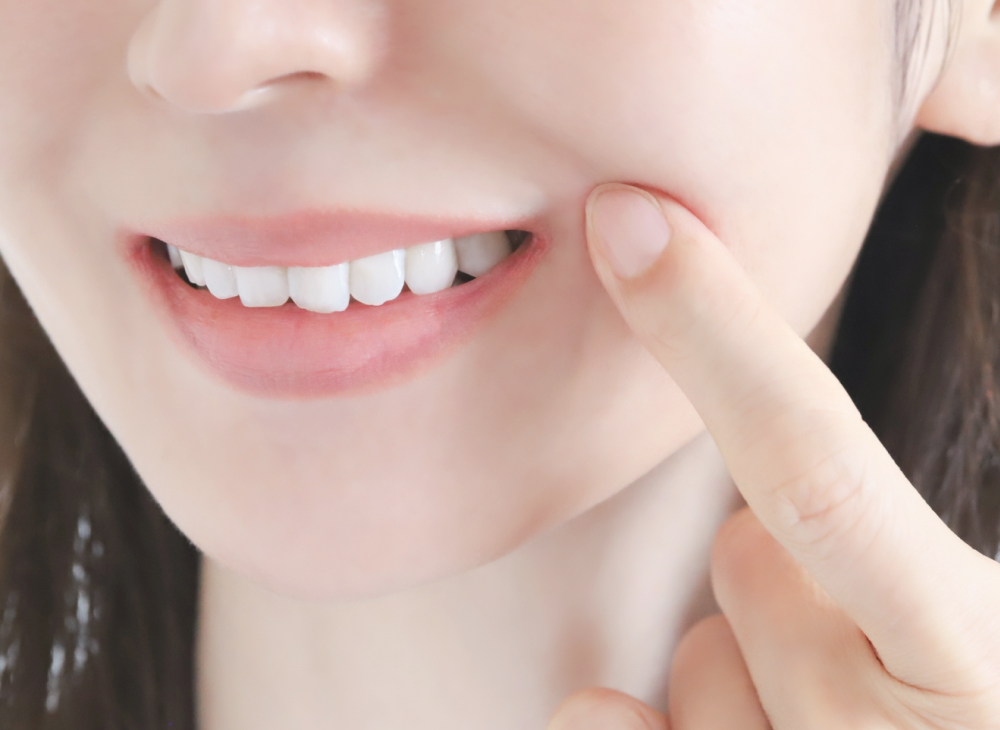 白くてきれいな詰め物に対応